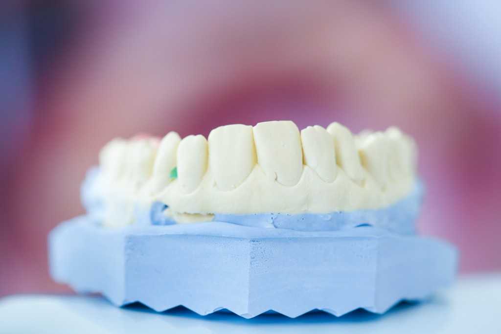 Teeth Misalignment